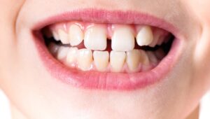 post thumbnail 4d372cc221c5705905a1c8d5c268c939